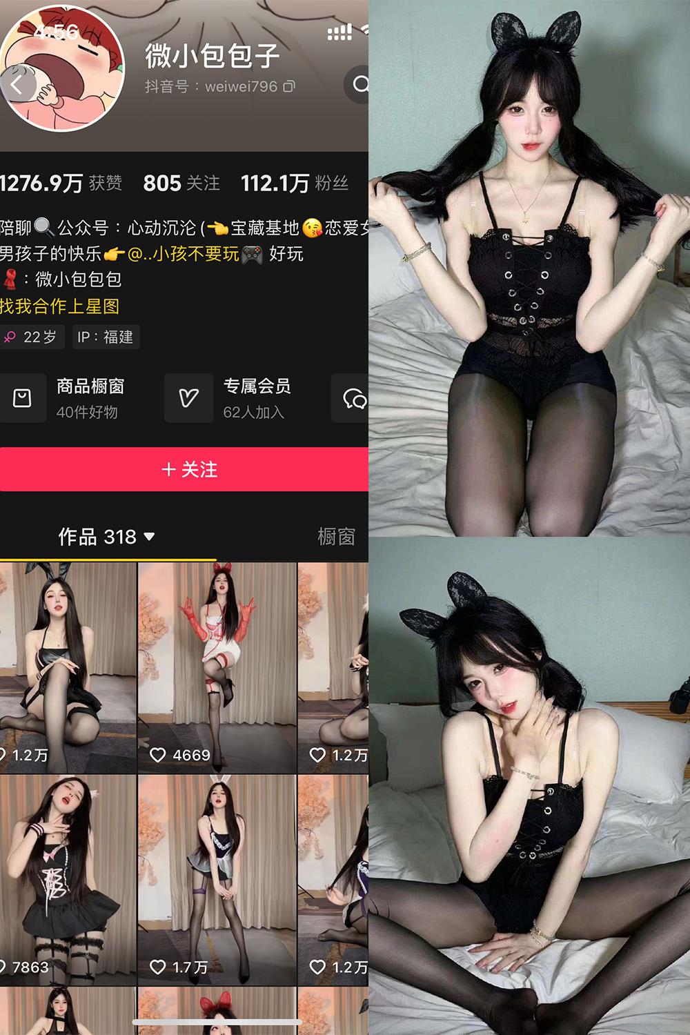 抖音 微小包包子 微密圈 NO.001期 【51P3V】资源在线观看