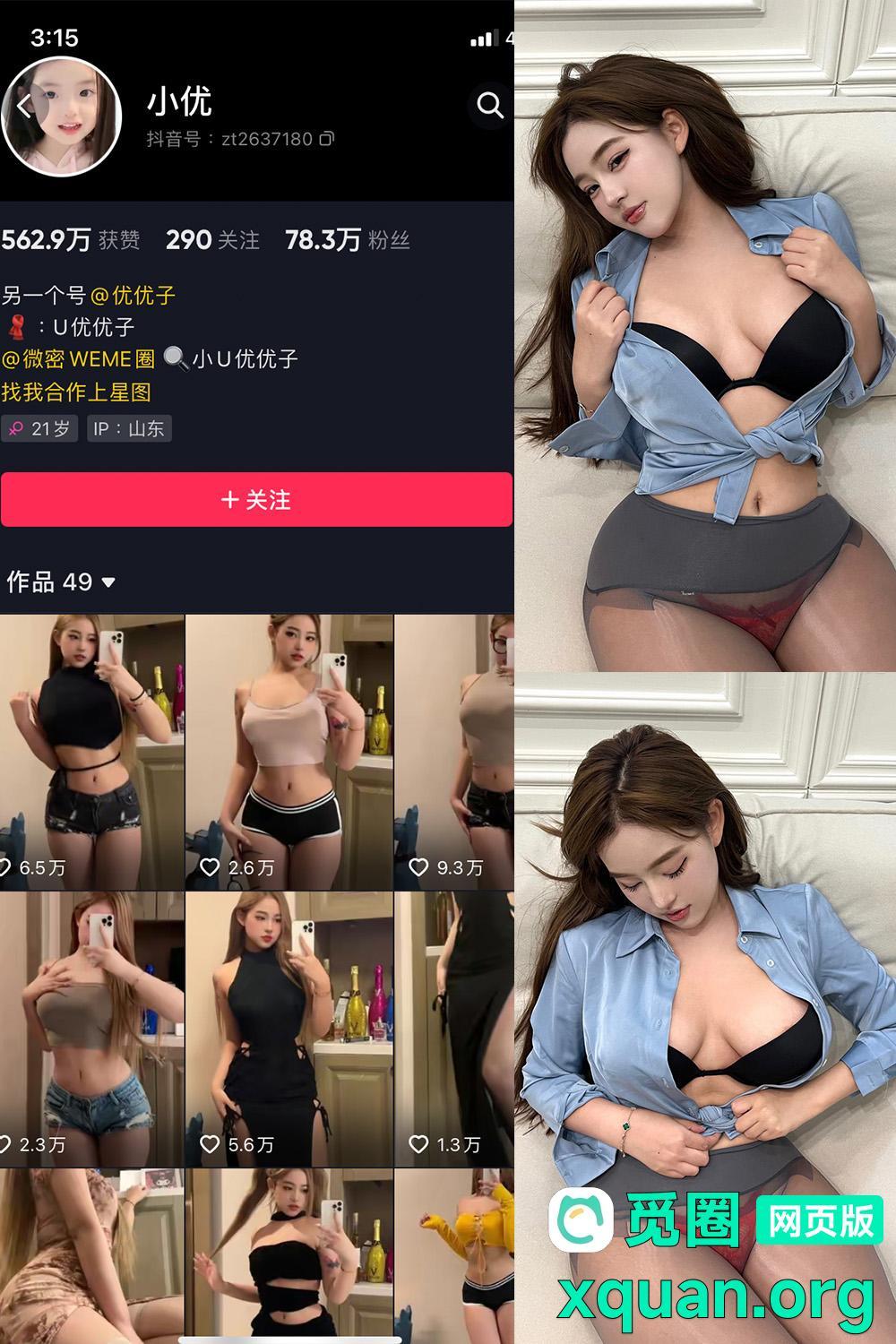 秘语空间 抖音 小U优优子 趣岛 NO.057期 【18P2V】内容更新至：2025年08月07日资源在线观看