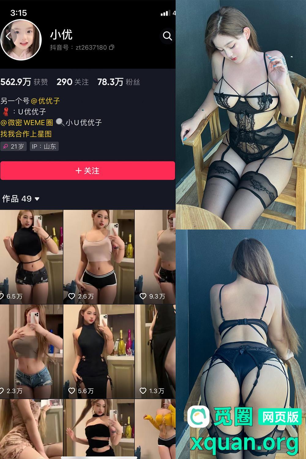 秘语空间 抖音 小U优优子 趣岛 NO.056期 【24P1V】内容更新至：2025年08月01日资源在线观看