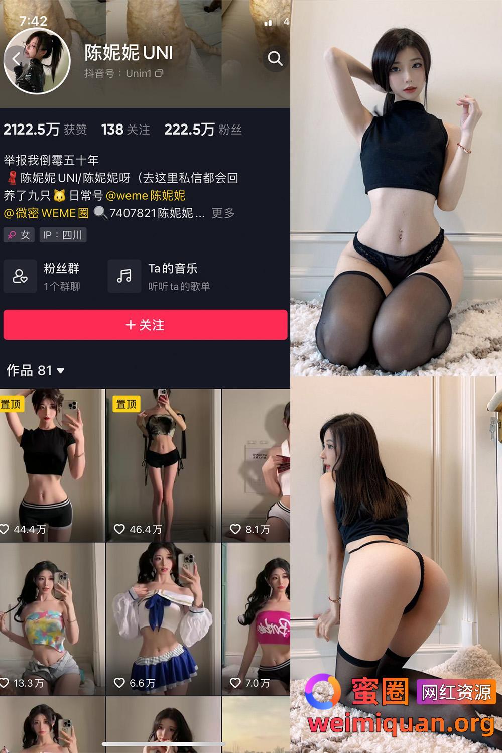 抖音 陈妮腻UNI 微密圈 觅圈 NO.031期 【46P】资源在线观看