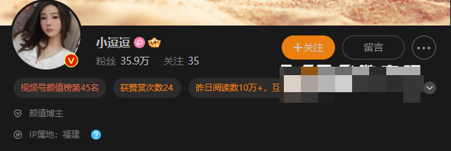 小逗逗微密圈视频拍摄手法如何(小逗逗维密图集精选作品) 小逗逗微密圈视频拍摄手法如何(小逗逗维密图集精选作品)