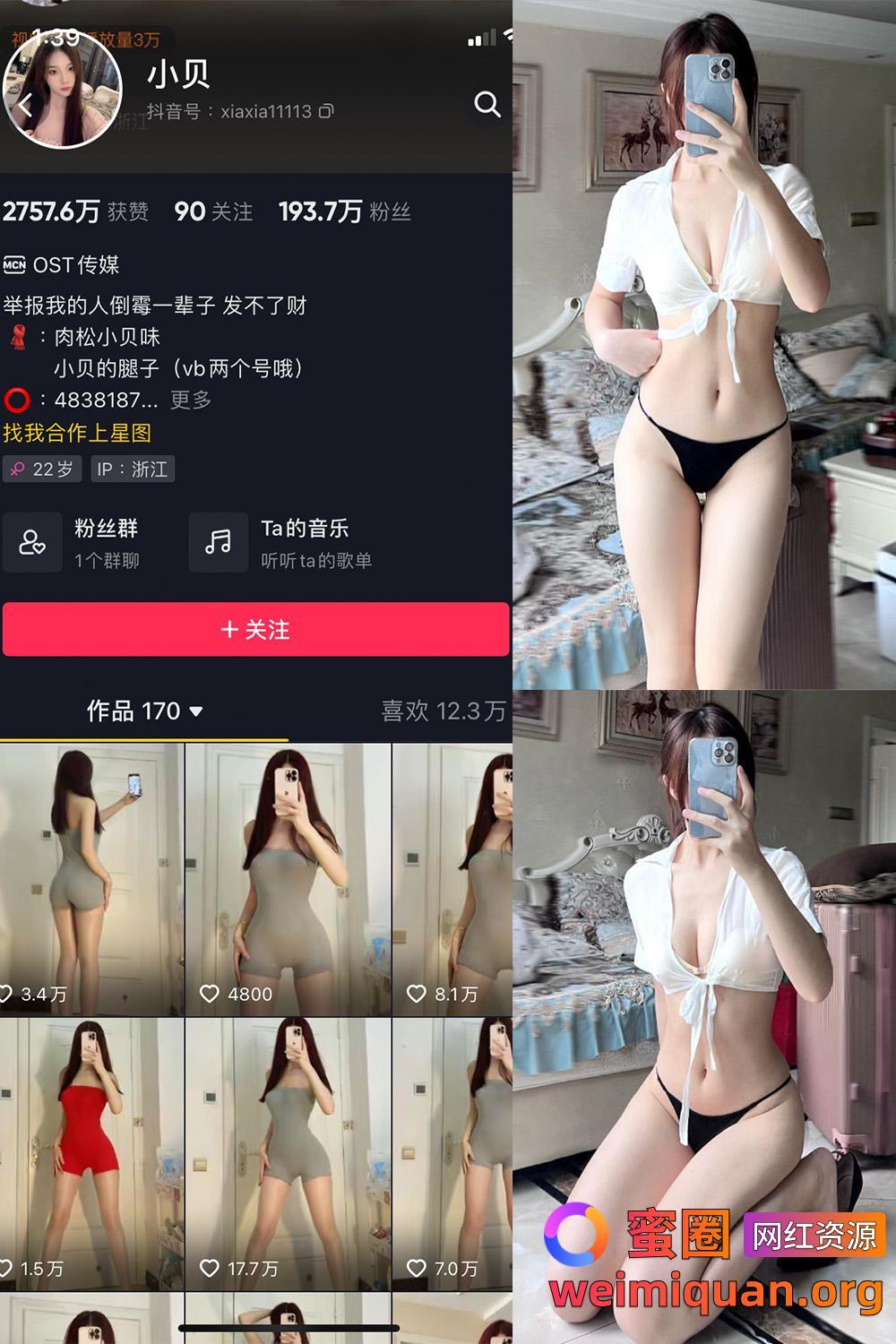 抖音女网红吃瓜黑料 觅圈 小贝 VIP 微密圈 NO.005期 【28P】资源在线观看 抖音女网红吃瓜黑料 觅圈 小贝 VIP 微密圈 NO.005期 【28P】资源在线观看