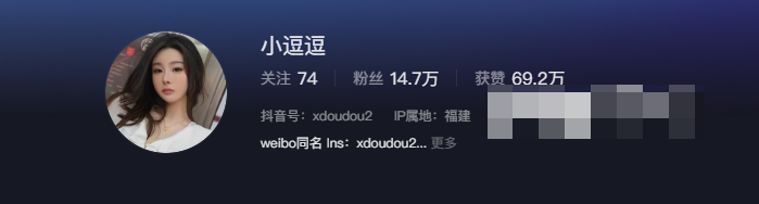 抖音网红小逗逗微密圈精选作品资源什么梗？