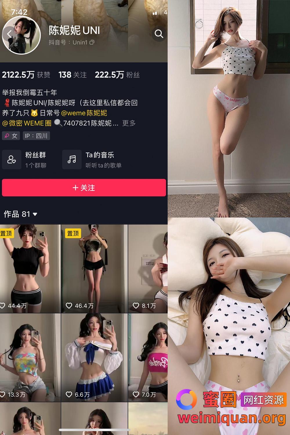 抖音 陈妮腻UNI 微密圈 觅圈 NO.044期 【22P】资源在线观看