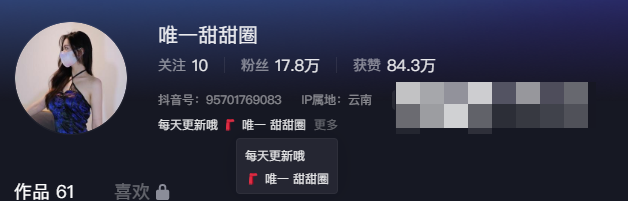 抖音网红唯一甜甜圈微密圈资源有什么？