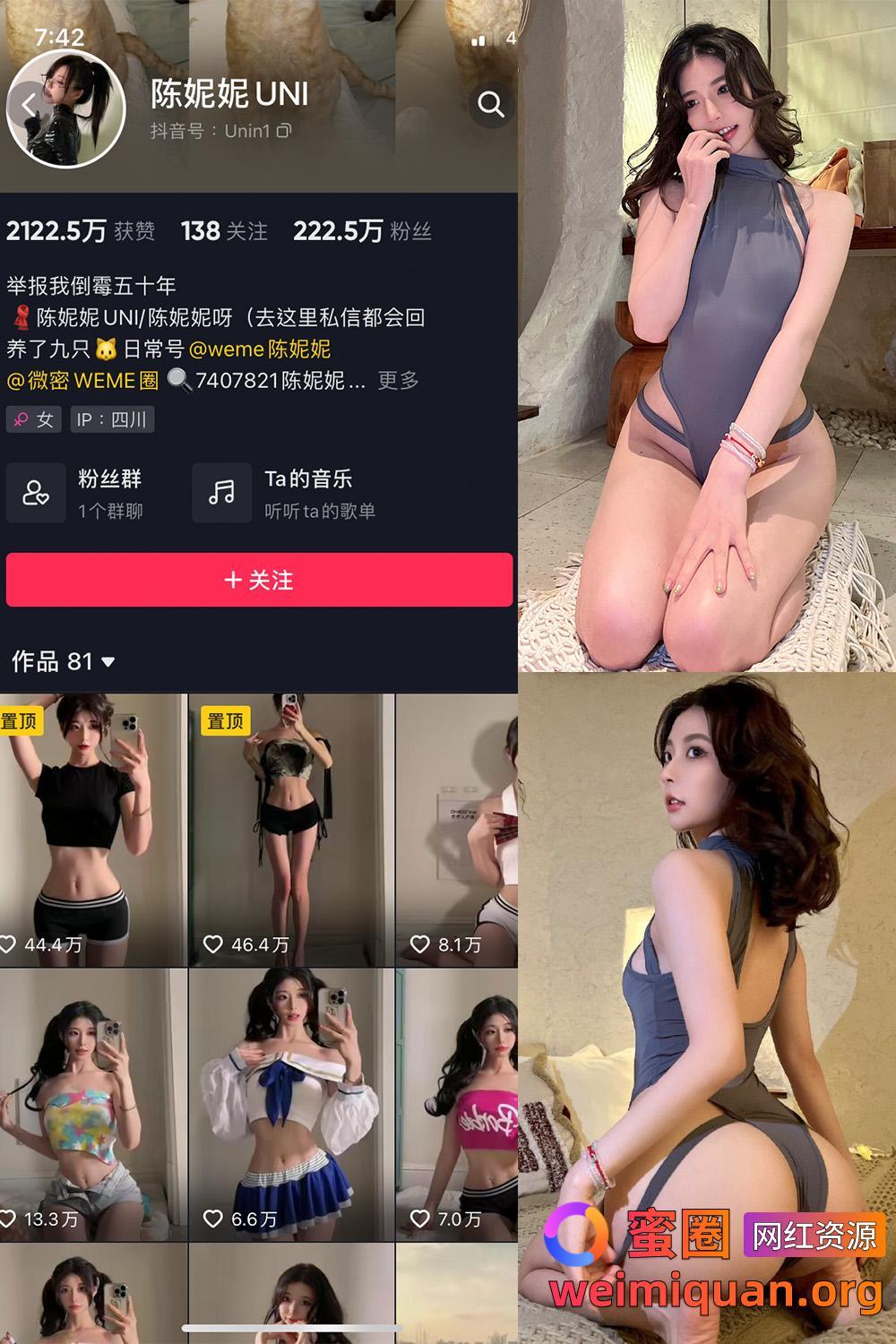 抖音 陈妮腻UNI 微密圈 觅圈 NO.047期 【34P】资源在线观看