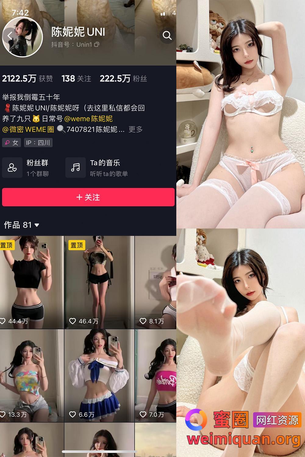 抖音 陈妮腻UNI 微密圈 觅圈 NO.014期 【22P】资源在线观看 抖音 陈妮腻UNI 微密圈 觅圈 NO.014期 【22P】资源在线观看