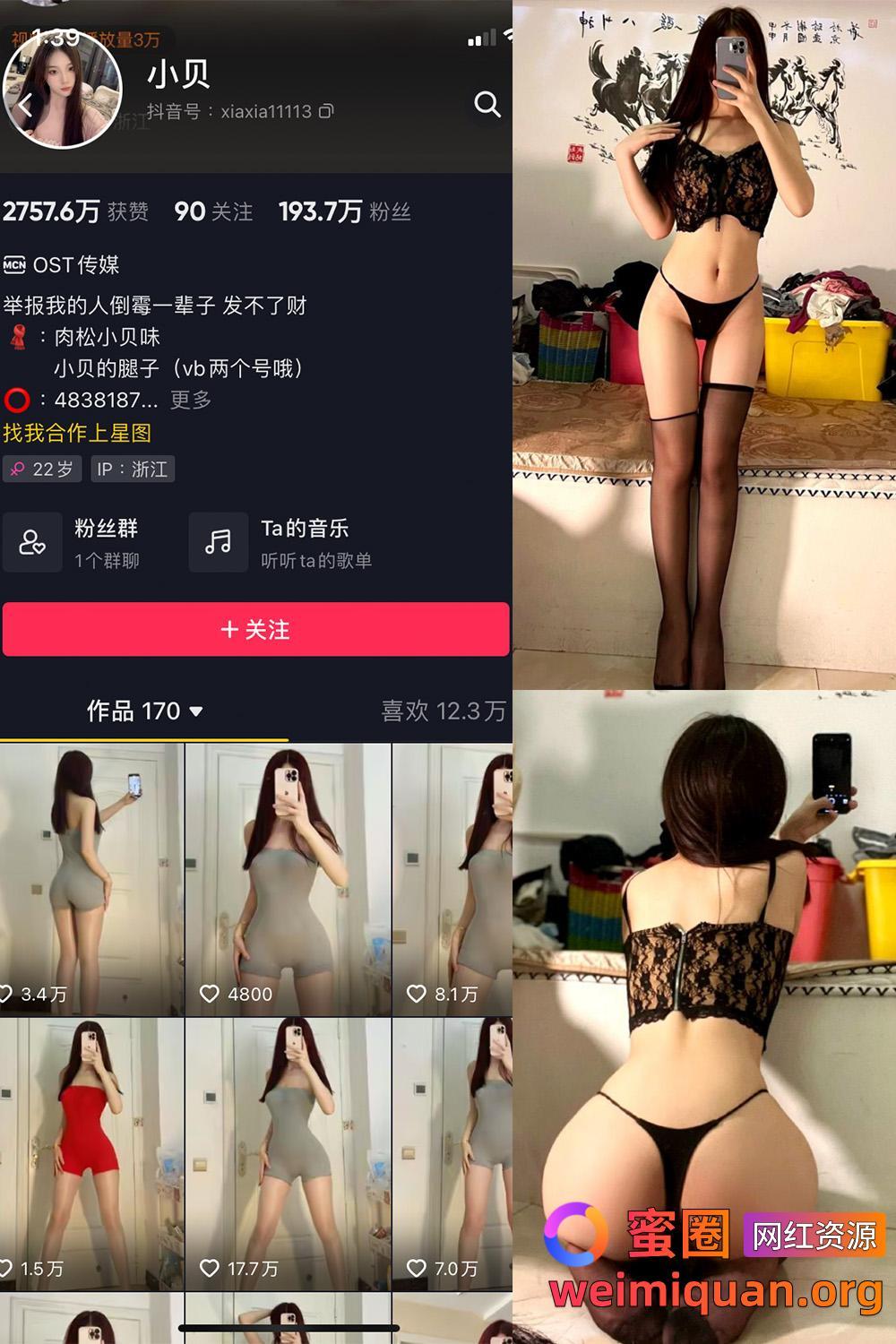 抖音女网红吃瓜黑料 觅圈 小贝 VIP 微密圈 NO.006期 【19P】资源在线观看 抖音女网红吃瓜黑料 觅圈 小贝 VIP 微密圈 NO.006期 【19P】资源在线观看