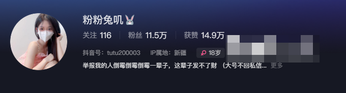 抖音网红粉粉兔叽微密圈精选资源如何获取？